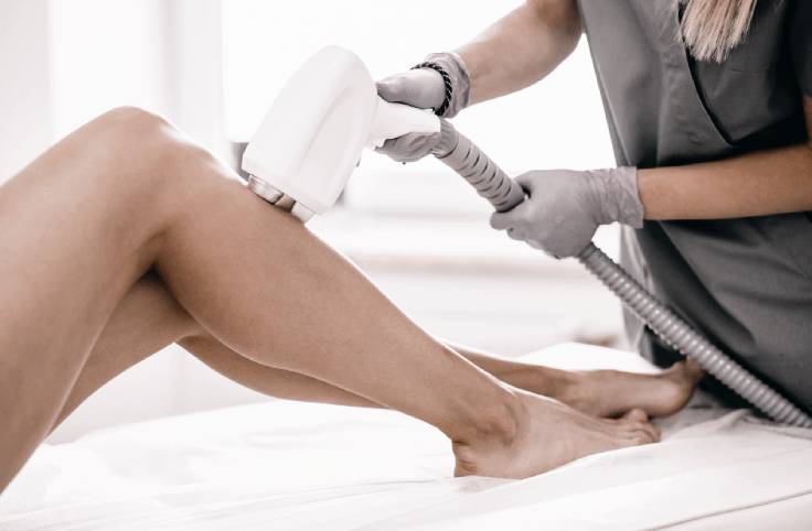 Laser Hair Removal