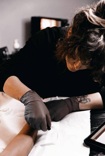 Laser Tattoo Removal